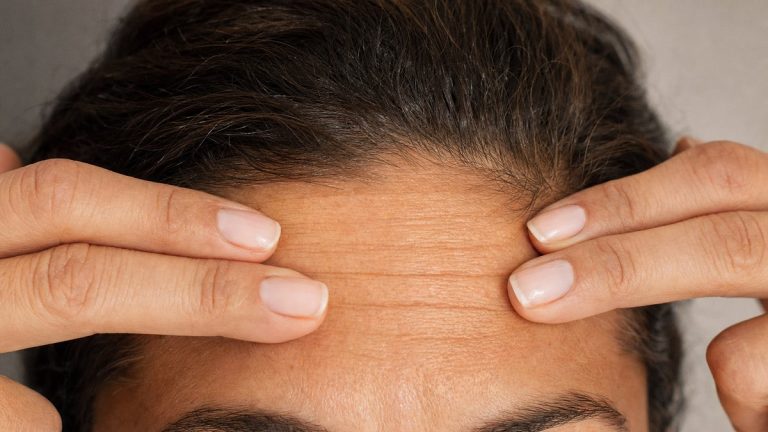 Rides du front dès 25 ans : ce que conseille une dermatologue parisienne pour les lisser sans chirurgie lourde