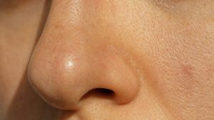 Points noirs sur le nez : Magali Bertin, facialiste de 43 ans, explique pourquoi la couleur n'a rien à voir avec la saleté